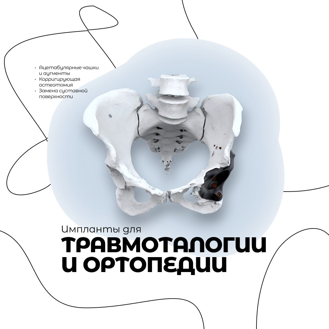 Пост медтех-компания — виды имплантатов